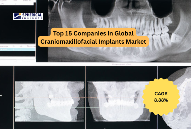 Craniomaxillofacial Implants Market