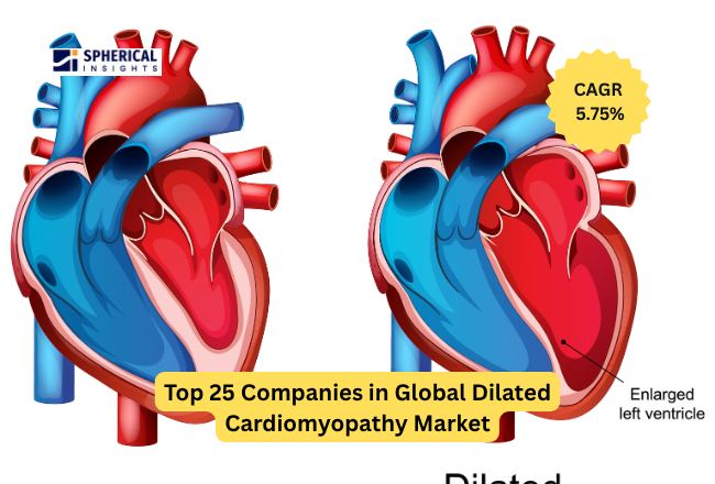 Dilated Cardiomyopathy Market 