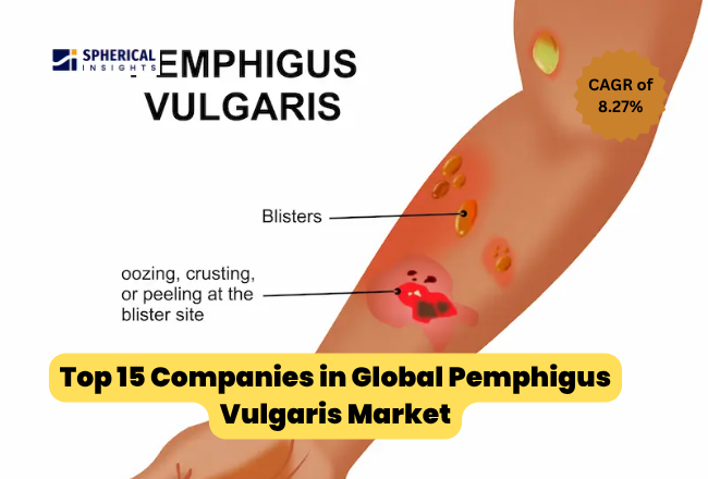 Pemphigus Vulgaris Market