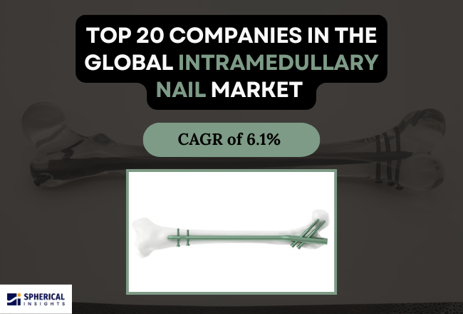 Intramedullary Nail Market 