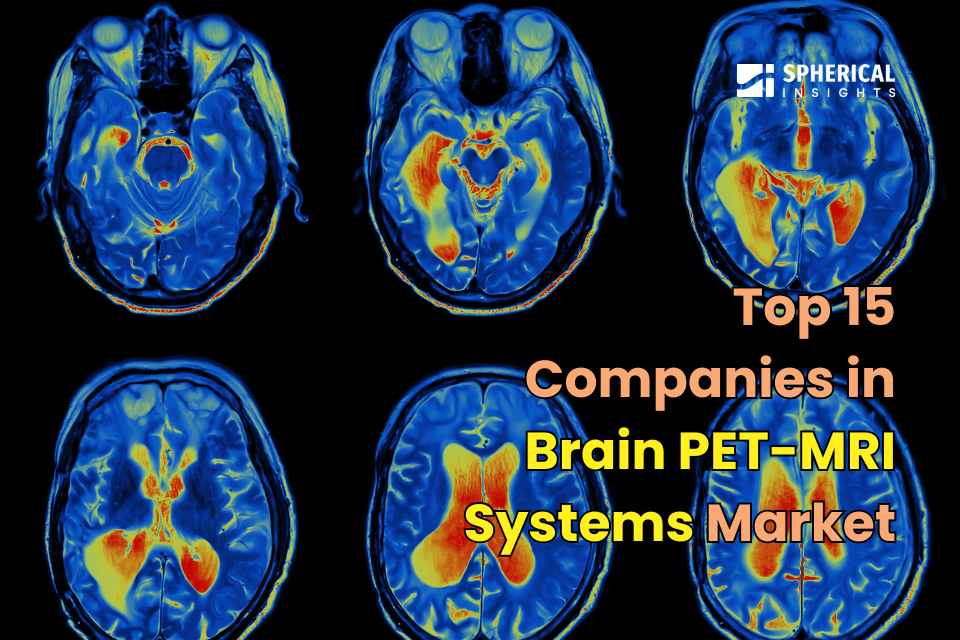 Brain PET-MRI Systems
