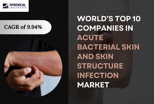  Adaptive Optics Components Market