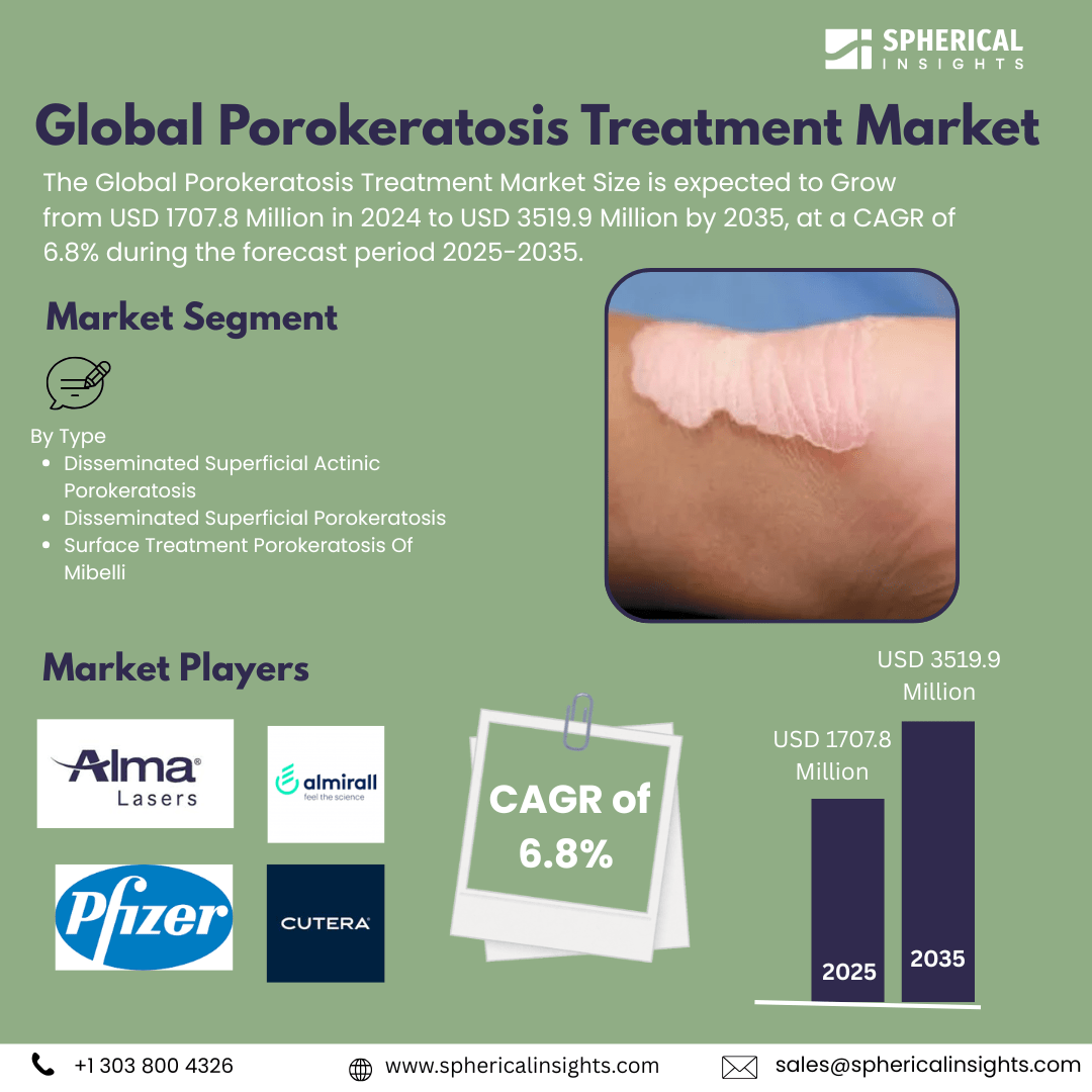 Global Porokeratosis Treatment Market Size Exceed to USD 3519.9 Million by 2035| CAGR of 6.8% : Forecast Analysis Report