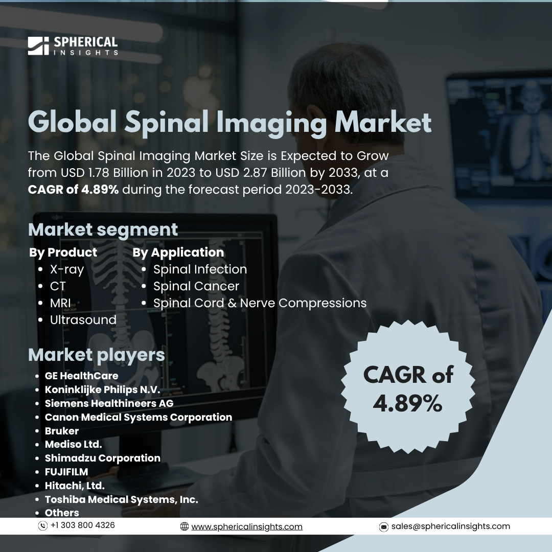 Global Spinal Imaging Market Size To Exceed USD 2.87 Billion By 2033: Forecast Analysis Report