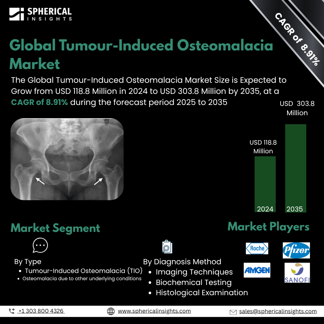 Global Tumour-Induced Osteomalacia Market Size To Exceed USD 303.8 Million  by 2035 | CAGR of 8.91% : Market Study Report